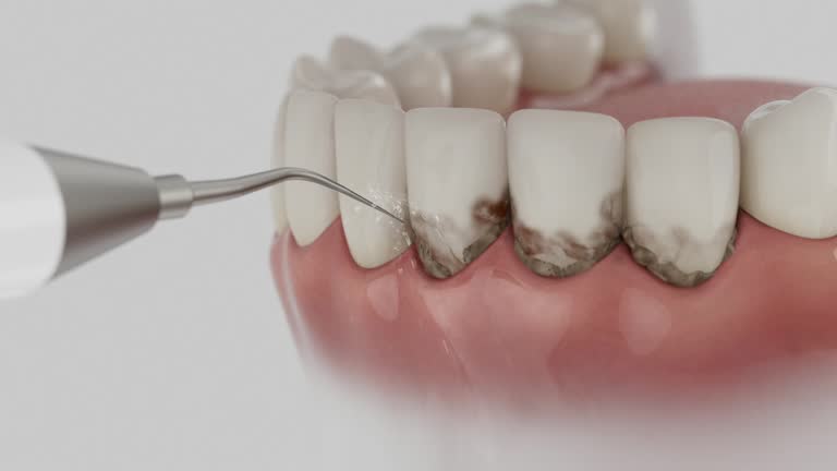 Reliable Dental contractor in Mountain Brook, AL by Smile Center Dentistry
